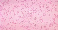 Study: We're losing the war against drug-resistant infections faster than we thought