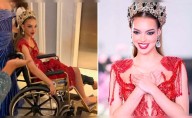 Candidata peruana al Miss Grand International 2025, Flavia López, revela lo que sintió tras aparatosa lesión: "Estaba en shock"