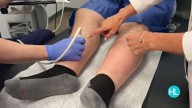 Tired Legs? Swelling? Sugar Land doctor reveals what’s really going on