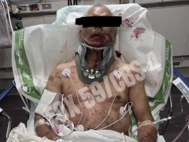 Family of man injured in Mark Sanchez stabbing gives update, felony charged filed against ex