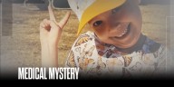 Young girl battling leukemia dies due to fungal infection while immunocompromised