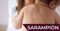 Muere bebé rarámuri por sarampión; suman 21 decesos en Chihuahua