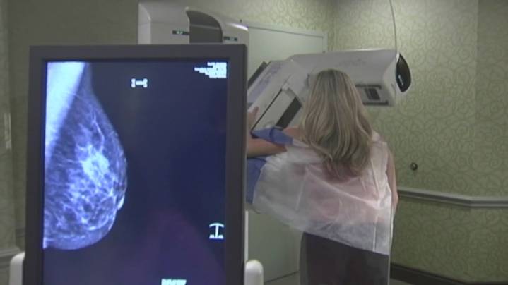 Woman's clean mammogram nearly missed second breast cancer diagnosis