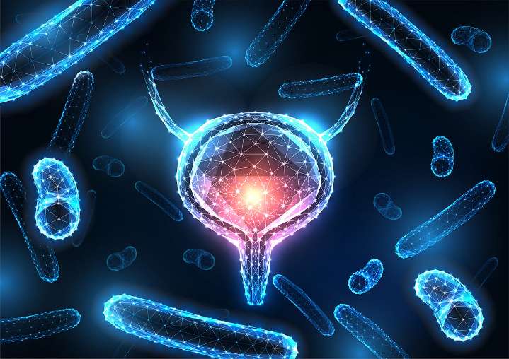 Challenges Seen in Diagnosing UTI in Children With Neurogenic Bladder