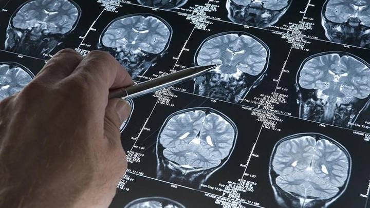 The urgent need to bring stroke rehabilitation into the mainstream