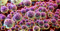 SDSE: Little-known bacteria causing increasing rates of potentially deadly infections