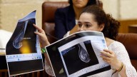 La teta de Anabel señala a Moreno: una diputada de Por Andalucía muestra una mamografía presuntamente manipulada