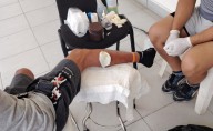 Migrante cubano con infección por gusano barrenador solicita apoyo a Sheinbaum para llegar a la CDMX