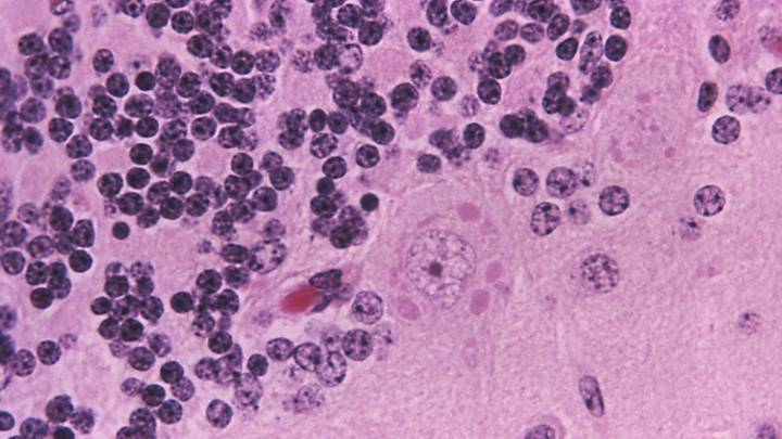 Bat found on sidewalk in Orange tests positive for rabies
