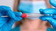 Test de HPV en Hospital Privado: una herramienta clave para prevenir el cáncer de cuello uterino