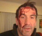 A horas de las elecciones. Un candidato a senador de LLA denunció que sufrió una entradera en su casa y fue golpeado