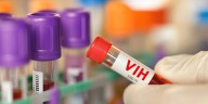 Descubren un anticuerpo con resultados prometedores ante casi todas las variantes del VIH: cómo funciona