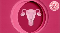 PCOS vs PCOD: It's not a disease, it's a syndrome says experts