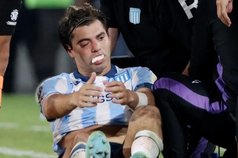Por el codazo de Marcos Rojo, Santiago Sosa sufrió una fractura y no volvería a jugar hasta 2026