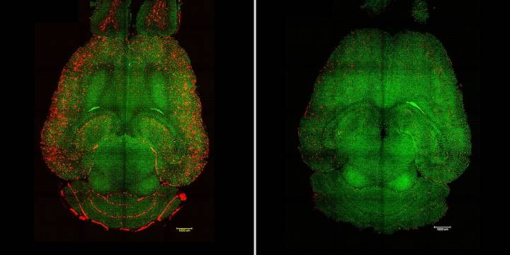 Científicos logran revertir el Alzheimer en ratones con una terapia basada en nanopartículas
