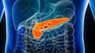 La enfermedad que se asocia a un mayor riesgo de cáncer de páncreas y de vías biliares, según un estudio