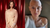 Victoria’s Secret rechazó solicitud de modelo de volver a la pasarela en medio de su lucha contra el cáncer