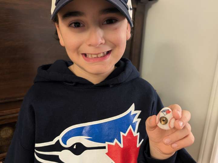Richmond Hill boy has 'fun eye' made to look like baseball