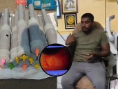 After MP, Bengal kids lose eyesight using carbide guns:Doctors warn of permanent blindness as homemade carbide guns explode, leaving several children critically injured