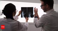 Early detection of rheumatoid arthritis: Why timely action can prevent joint damage