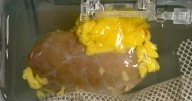 Científicos crean riñón universal que concuerda con cualquier tipo de sangre
