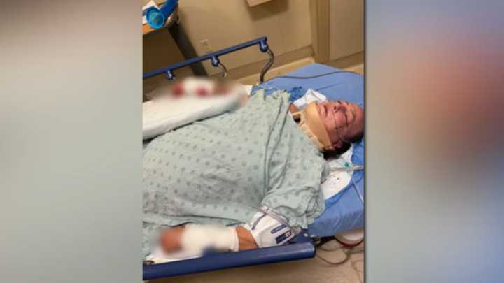 Victim recovering as owner in Lake Worth dog mauling still at large