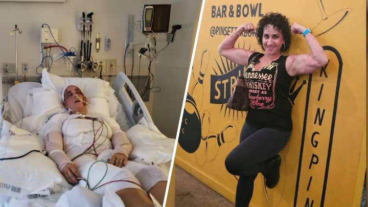 New Jersey community rallies behind woman injured in acid attack
