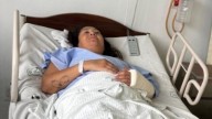 Una argentina cayó de un edificio en México, sufrió cinco fracturas y está grave: volverá en avión sanitario