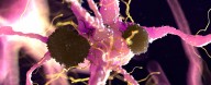 A Signal Hidden in The Brain May Reveal Alzheimer's Years in Advance