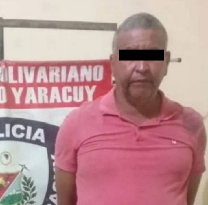MP imputa a cincuentón que incendió a su pareja en Yaracuy