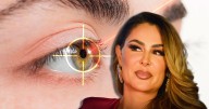 Ninel Conde se somete a cirugía para cambiar color de sus ojos: ¿Cómo es y cuáles son los riesgos?