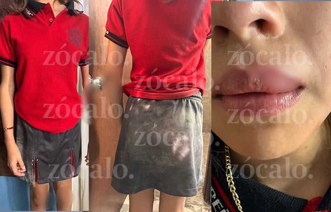 Denuncia madre de familia agresión y acoso escolar a su hija de secundaria en Sabinas