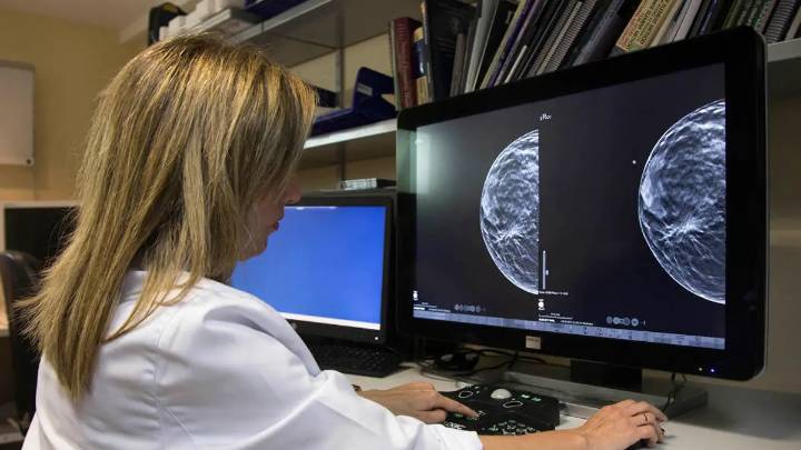 Andalucía eleva a 2.317 las mujeres afectadas por el cribado del cáncer de mama y 1.778 se han hecho ya mamografías