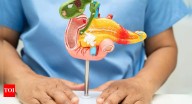 How to recognise bile duct cancer early and reduce your risk