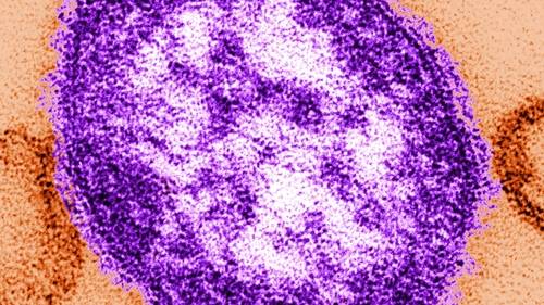 Measles exposure: New Jersey officials warn of person who passed through Newark International Airport with the virus