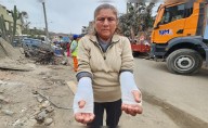 Mujer intentó salvar sus cosas en incendio en Pamplona Alta, pero se quemó ambos brazos: “No tengo nada”