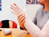 Cáncer de mama: linfedema, el mal a vencer
