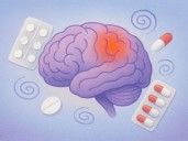 ¿Paracetamol? ¿Cafeína? Automedicarte podría causar que la migraña no se te quite