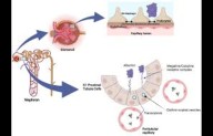 Lowering Albuminuria Improves Survival and Kidney Outcomes in Diabetes