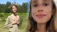 Muere mujer de 27 años que comía solo frutas y pesaba 22 kilos; ¿qué le pasó?