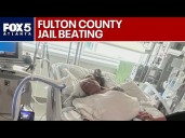 Mother: Disabled daughter beaten, left lifeless