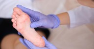 Measles Outbreak Spreads Beyond Utah-Arizona Border, 123 Cases Reported