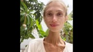 Cutting Out Protein? Woman Dies Of Starvation In Bali After Extreme Fruit