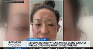 Multiple people sue after being burned when s'mores stand catches fire at restaurant