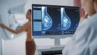 ¿A cuántas mujeres no se llamó a la mamografía en 2024 en cada área de salud?