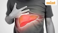 Sugar-sweetened drinks linked to higher risk of fatty liver disease, study finds