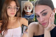 Exclusive | Women under 30 opting for major plastic surgery, alarming experts