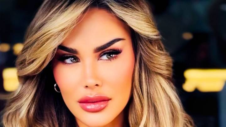 Este es el costoso procedimiento al que se sometió Ninel Conde y con el que pudo perder la vista