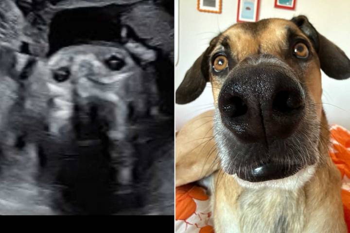 Woman's Sonogram Images Have 'Uncanny' Resemblance to Dog (Exclusive)