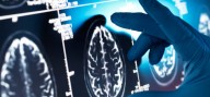 Estudio revela que hasta el 45% de los casos de Alzheimer podrían prevenirse